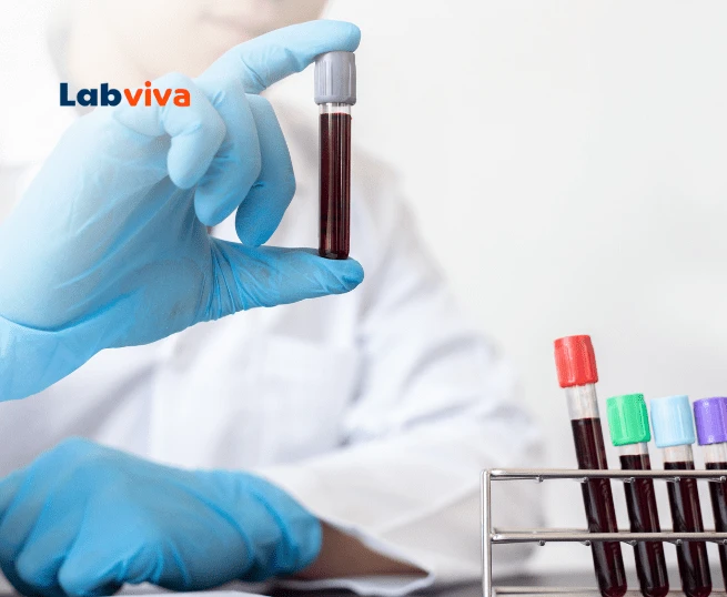 LabViva - Seu Laboratório de Análises Clínicas em Batatais